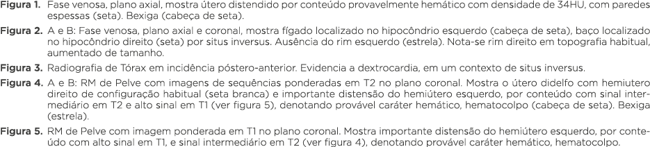 Figura 1  Fase venosa, plano axial, mostra útero distendido por conteúdo provavelmente hemático com densidade de 34HU   