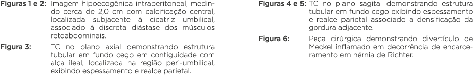 Figuras 1 e 2: Imagem hipoecogênica intraperitoneal, medindo cerca de 2,0 cm com calcificação central, localizada sub   