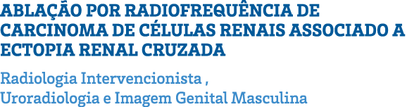 ABLAÇÃO POR RADIOFREQUÊNCIA DE CARCINOMA DE CÉLULAS RENAIS ASSOCIADO A ECTOPIA RENAL CRUZADA Radiologia Intervencioni   