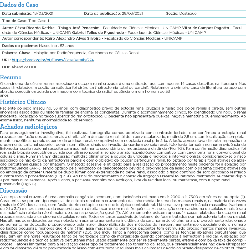 Dados do Caso   Resumo O carcinoma de células renais associado à ectopia renal cruzada é uma entidade rara, com apena   