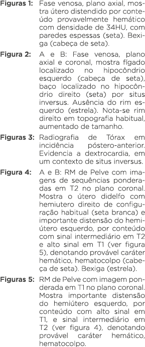 Figuras 1: Fase venosa, plano axial, mostra útero distendido por conteúdo provavelmente hemático com densidade de 34H   