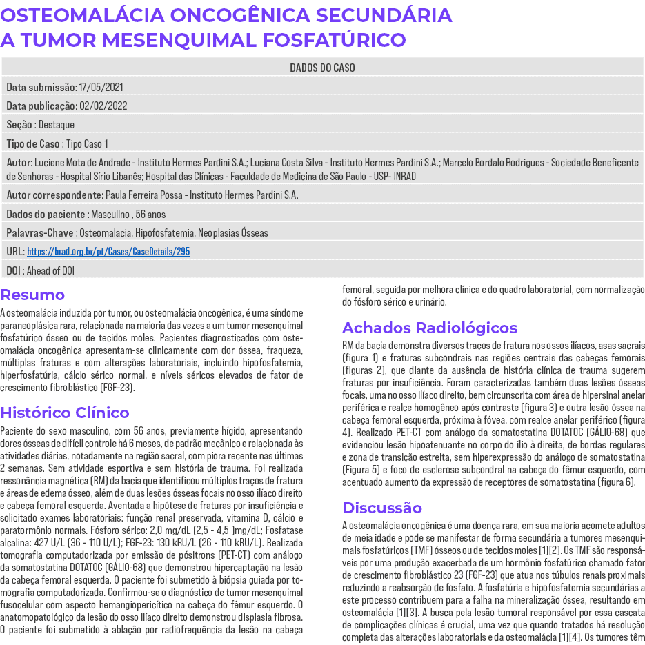 OSTEOMALÁCIA ONCOGÊNICA SECUNDÁRIA A TUMOR MESENQUIMAL FOSFATÚRICO   Resumo A osteomalácia induzida por tumor, ou ost   