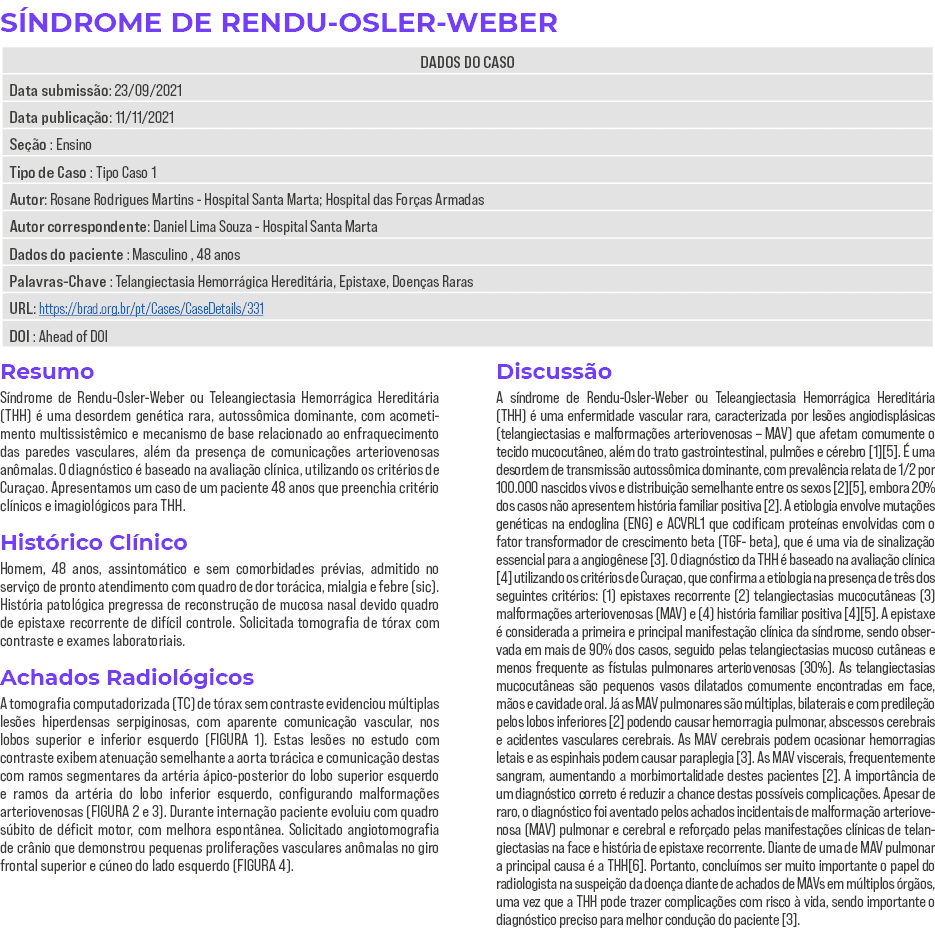 SÍNDROME DE RENDU-OSLER-WEBER   Resumo Síndrome de Rendu-Osler-Weber ou Teleangiectasia Hemorrágica Hereditária (THH)   