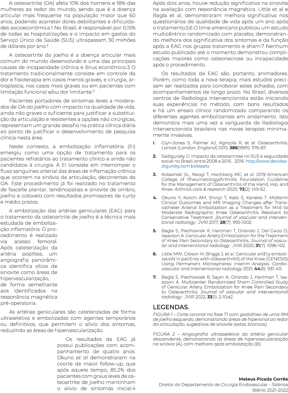 A osteoartrite (OA) afeta 10% dos homens e 18% das mulheres ao redor do mundo, sendo que é a doença articular mais fr   
