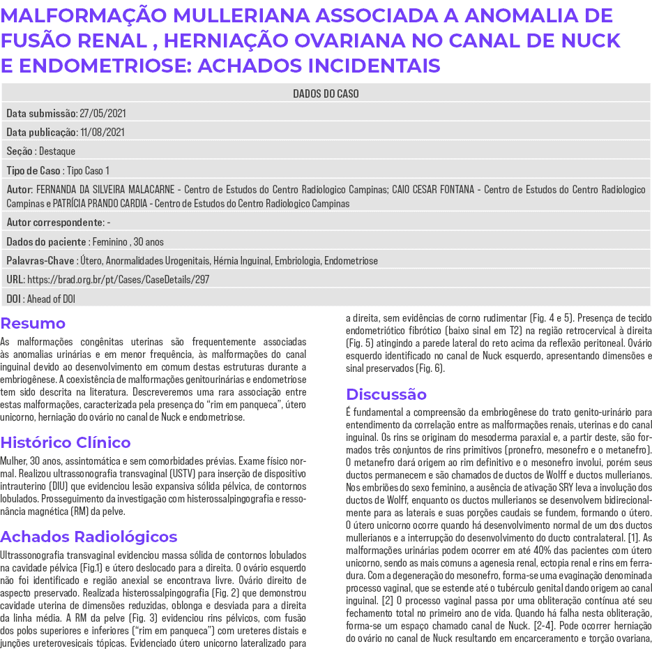 MALFORMAÇÃO MULLERIANA ASSOCIADA A ANOMALIA DE FUSÃO RENAL , HERNIAÇÃO OVARIANA NO CANAL DE NUCK E ENDOMETRIOSE: ACHA   