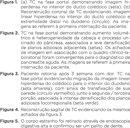 Figura 1  (a) TC na fase portal demonstrando imagem hiperdensa no interior do ducto colédoco (seta)  (b) Reconstrução   