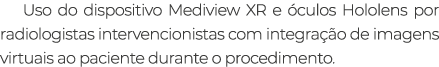 Uso do dispositivo Mediview XR e culos Hololens por radiologistas intervencionistas com integra  o de imagens virtua...