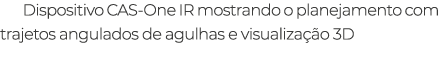 Dispositivo CAS-One IR mostrando o planejamento com trajetos angulados de agulhas e visualiza o 3D