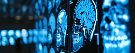 Brain MRI x-ray in the hospital. Diagnostics, and Medicine and health care concept. High quality photo