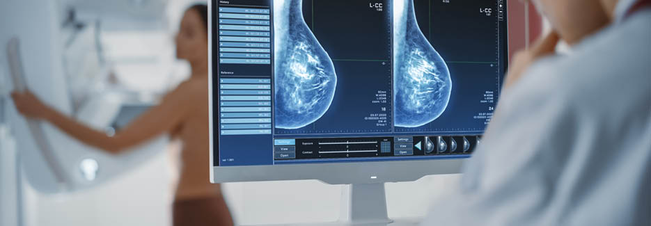Computer Screen in Hospital Radiology Room: Beautiful Multiethnic Adult Woman Standing Topless Undergoing Mammography Screening Procedure. Screen Showing the Mammogram Scans of Dense Breast Tissues.